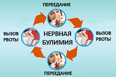 Лечение булимии в Усть-Джегуте